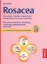 Buchcover und Innenansicht für das Buch: Rosacea